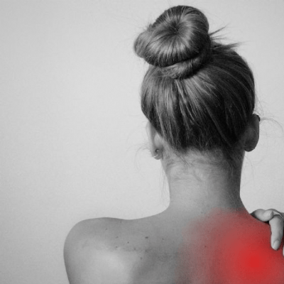 Frozen-Shoulder