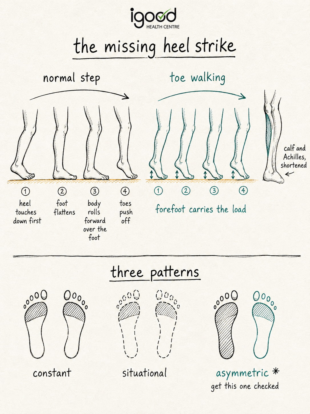 Causes of Lifelong Toe Walking That