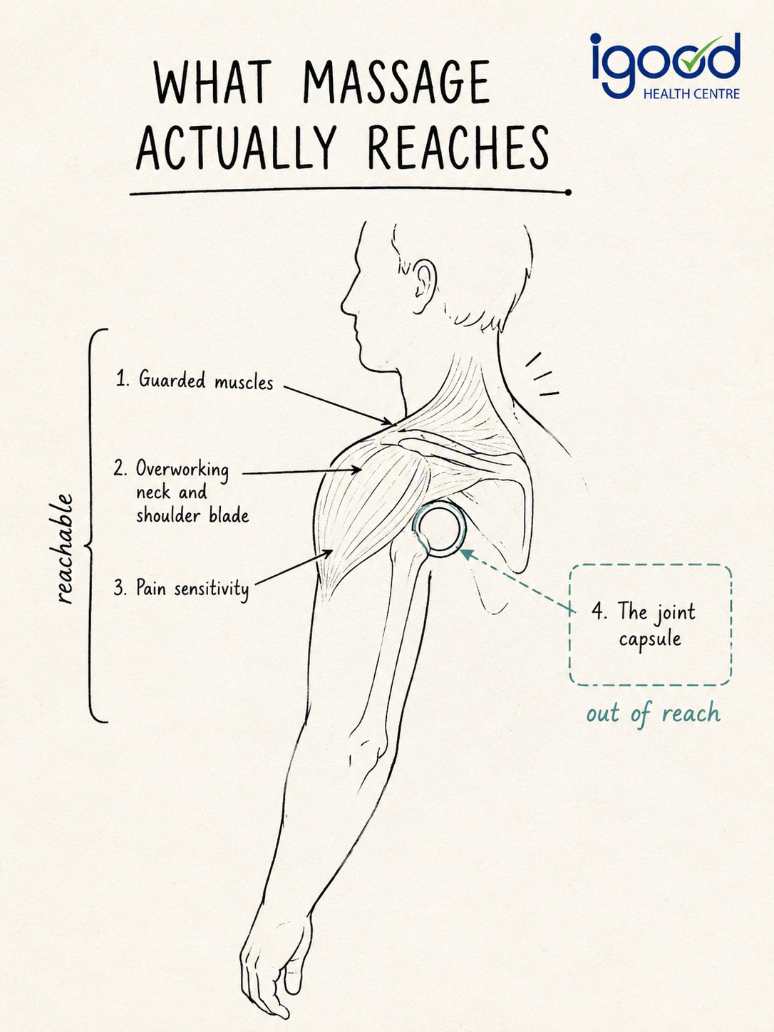 How Massage Therapy Acts on a Frozen Shoulder
